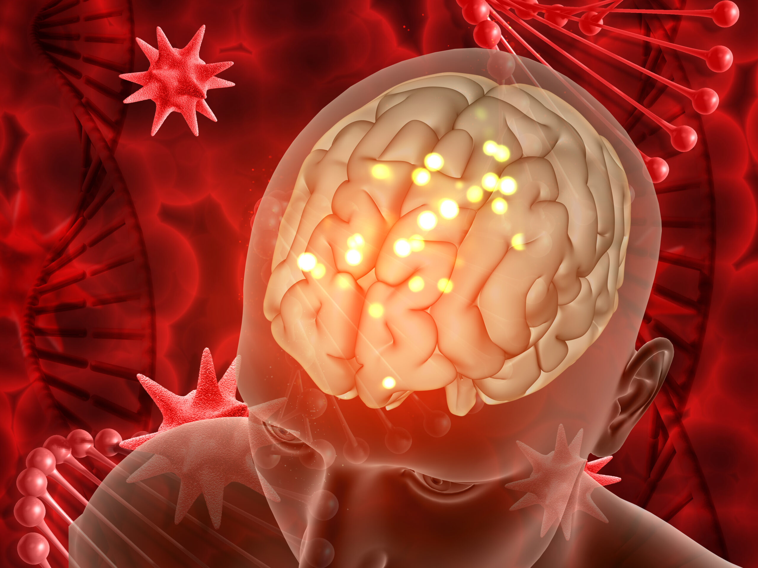 Neurotoxoplasmose